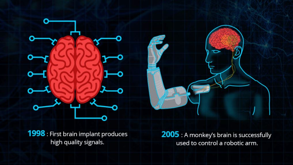 171115-brain-interface-infographic-mn-1520.jpeg