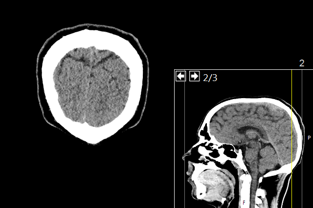 Brain Science: Memory | Controlling Intrusive & Unwanted Thoughts?