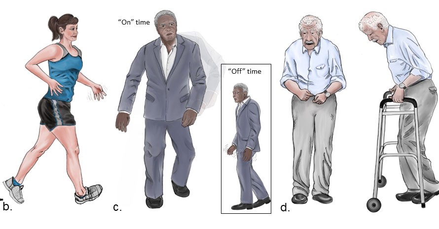 Brain Science: Could the Thalamus Cause Alzheimer’s & Parkinson’s?