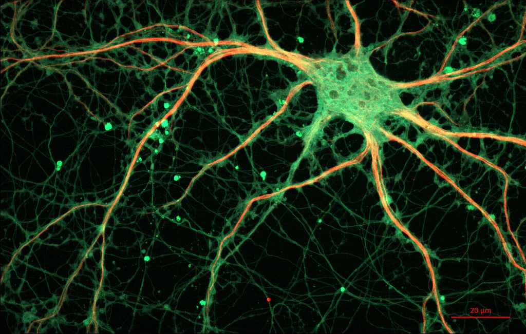 Thalamic Hippocampal Relays of Thought Memory | Consciousness Neurobiology