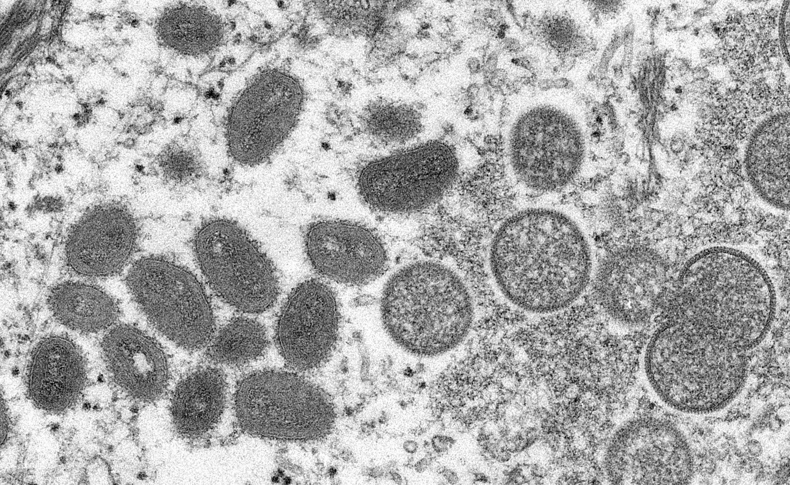 Monkeypox: Computational Hemodynamics | Virology Bubbles Research