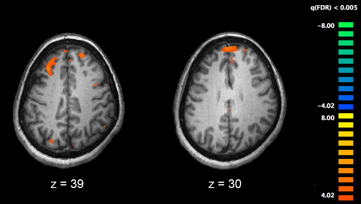 Neuroplasticity: Memory | Disability, Disorder and Neurodegeneration