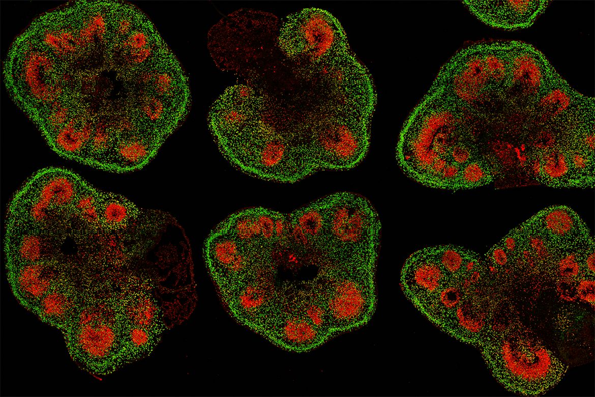 Neurobiology: The Consciousness of Organoids, Biocomputers and Artificial Intelligence