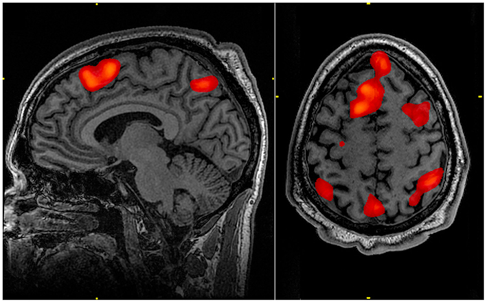 Brain Science & Psychology: What If the Working Memory is Flawed?